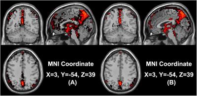 Frontiers | The Brain Alteration of Seafarer Revealed by Activated